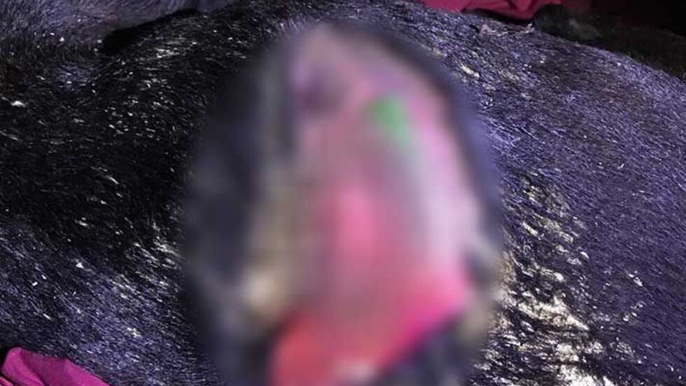 When his family found him, Buddy had a deep stab wound from his back to his abdomen. (Source:...