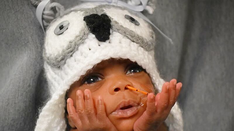 NICU baby at UofL Hospital in Louisville dressed in a Halloween costume